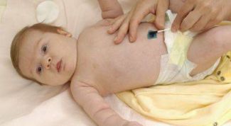 Картинка по теме - как обрабатывать пупок новорожденного