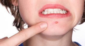 Картинка по теме - как убрать красноту прыщей