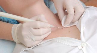 Картинка по теме - как удалить липому