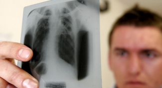 Картинка по теме - как узнать, есть ли у меня туберкулез