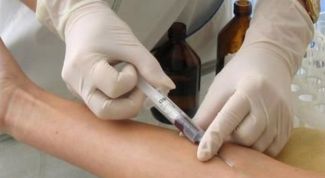 Картинка по теме - как убрать синяки от уколов