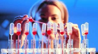 Картинка по теме - как сдавать анализ на сифилис