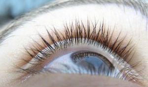 Картинка по теме - как убрать синяки и мешки под глазами