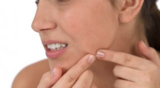 Картинка по теме - как удалить прыщи быстро