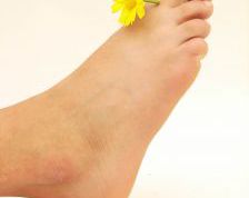 Картинка по теме - как убрать натоптыши на ногах