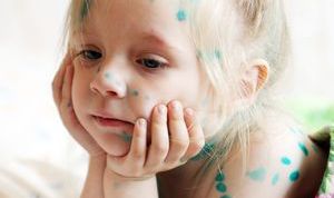 Картинка по теме - как распознать ветрянку