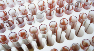 Картинка по теме - как разобраться в анализах