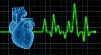 Картинка по теме - как прочесть кардиограмму