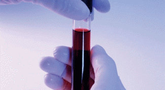 Картинка по теме - как снизить алт