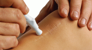 Картинка по теме - как сделать растяжки незаметными