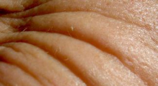 Картинка по теме - как убрать гусиные лапки под глазами