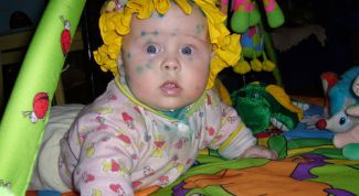 Картинка по теме - как избавиться от шрамов после ветрянки