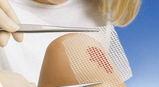 Картинка по теме - как избежать ожогов