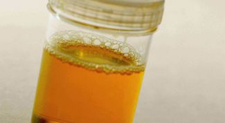 Картинка по теме - как вывести оксалаты