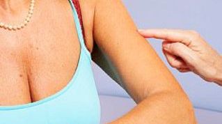 Картинка по теме - как лечить ихтиоз