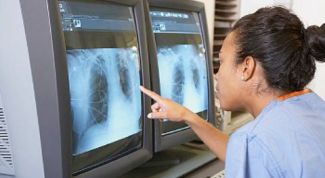 Картинка по теме - как лечить пневмонию народными средствами