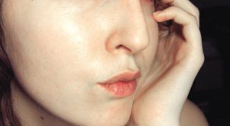 Картинка по теме - как свести прыщи