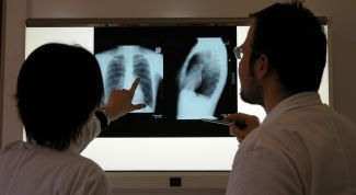 Картинка по теме - как лечить сломанные ребра