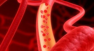 Картинка по теме - как очистить сосуды от бляшек