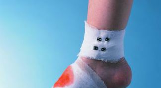 Картинка по теме - как остановить кровь из раны