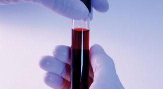 Картинка по теме - как проверить гормональный фон