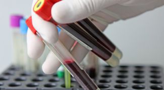 Картинка по теме - как проверить надпочечники