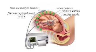 Картинка по теме - как прослушать сердцебиение плода