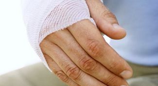 Картинка по теме - как определить перелом руки