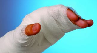 Картинка по теме - как лечить ожог кожи