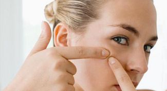 Картинка по теме - как перестать давить прыщи