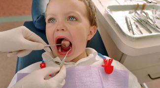 Картинка по теме - как лечить молочные зубы