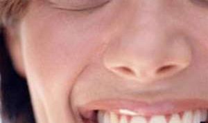 Картинка по теме - как снять воспаление зуба