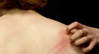 Картинка по теме - как успокоить зуд