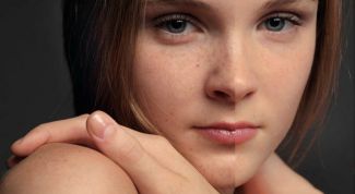 Картинка по теме - как убрать веснушки в фотошопе