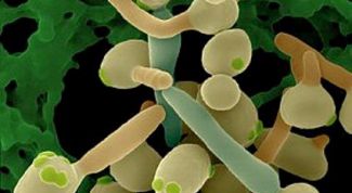 Картинка по теме - как избавиться от кандидоза