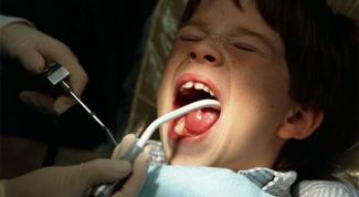 Картинка по теме - как лечить зубы маленьким детям