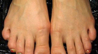 Картинка по теме - как увеличить стопы