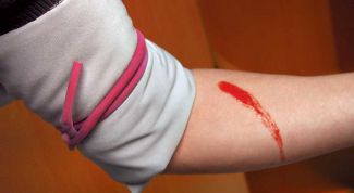 Картинка по теме - как остановить артериальное кровотечение