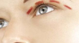 Картинка по теме - как подтянуть кожу вокруг глаз