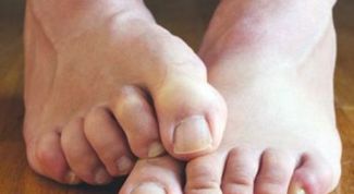 Картинка по теме - как лечить грибковые заболевания