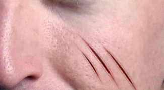 Картинка по теме - как сделать шрам