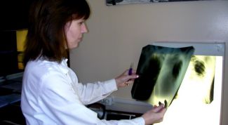 Картинка по теме - как выявить туберкулез