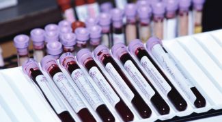 Картинка по теме - как понять результаты анализов