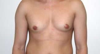 Картинка по теме - как уменьшить грудь у мужчин