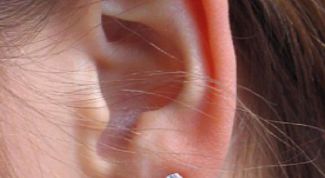 Картинка по теме - как лечить мочку уха