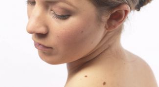 Картинка по теме - как лечить меланому