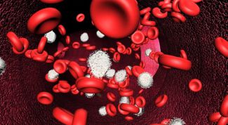 Картинка по теме - как лечить анемию народными средствами