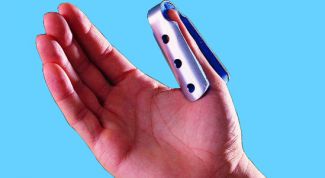 Картинка по теме - как лечить перелом пальца