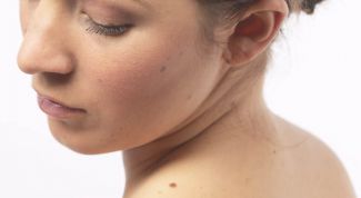 Картинка по теме - как отличить родинку от папилломы