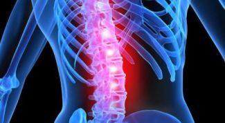 Картинка по теме - как лечить лордоз